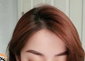 -大麦微针植发丨全国连锁