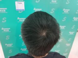 点击看大图 -雍禾植发全国连锁