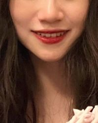 体验后-厦门美莱整形美容医院