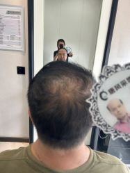 -唐风采假发补发定制