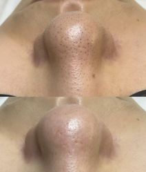 -禾壹净·素颜美问题肌肤修护中心