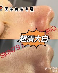 -SKIN79皮肤管理中心