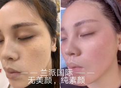 -兰派国际美容养生SPA