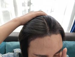 -雍禾植发全国连锁