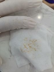 -蕾特恩专业祛痘国际连锁