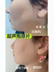 -亿美医疗美容·半岛大超炮官方授权店