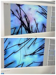 -史云逊养发护发