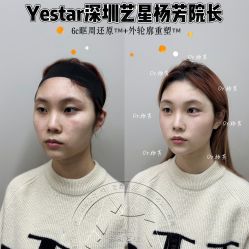 -深圳艺星医疗美容医院