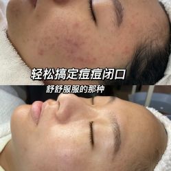 -Cream88颜皮肤管理中心