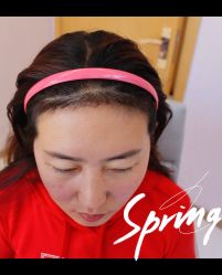 -大麦微针植发全国连锁