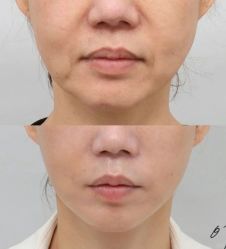 -韩辰医疗整形美容医院