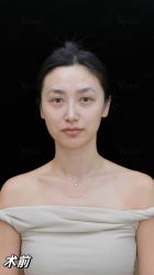 -Yestar重庆艺星医疗美容医院