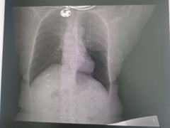 -瑞慈体检上海普陀机构