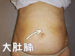 点击看大图 -Lily纤美·科技减脂中心