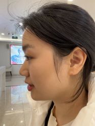 -长沙雅美医疗美容医院