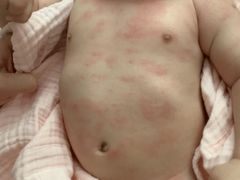 -成都市第一人民医院(南区)