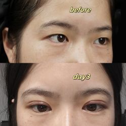 -素美医疗美容·西南眼鼻整形·修复基地
