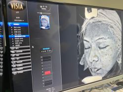 -广州健丽·去眼袋医疗美容机构