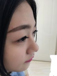 -YooMee优美智能科技美肤机构