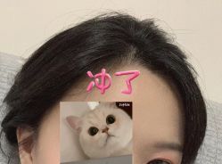 -大麦微针植发全国连锁