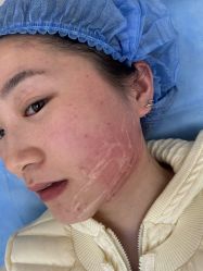 -四川米兰柏羽医学美容医院