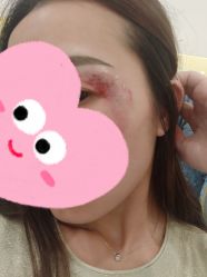 -美莱医学美容医院