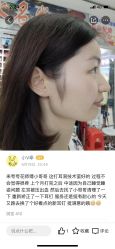 -花师傅穿孔·手穿·耳洞吧