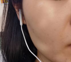 -北京美痣堂古方祛痣斑疣瘊