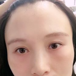 -八大处整形