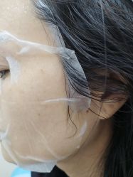 -长沙雅美医疗美容医院
