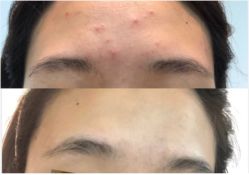 -SOS修丽可.痘肌修复中心