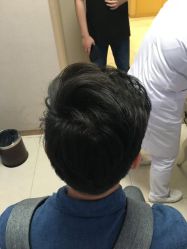 -大麦微针植发丨全国连锁