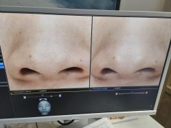 -苑苑vbeauty科技美容SPA