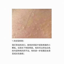 -美肤盾祛痘·问题肌头疗管理中心