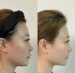 -杭州米兰柏羽医疗美容医院