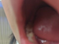 -常熟玉蕙口腔医院