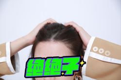 -大麦微针植发丨全国连锁