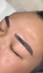 点击看大图 -诺恩Skin·科技美肤
