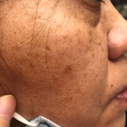 -大华韩艺整形美容医院