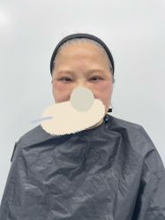 -天津健丽·去眼袋医疗美容机构