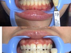 -Dr.Z dental仁康种植矫正中心