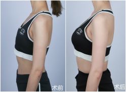 -美莱医学美容医院