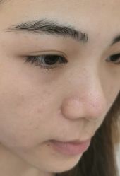 体验后-恒妍医美·韩国定制抗衰中心