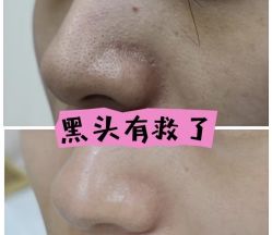 -SKIN79皮肤管理中心