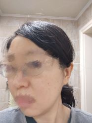 -小忠丽格医美