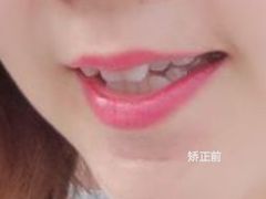 -齐玉齿科JADENTAL