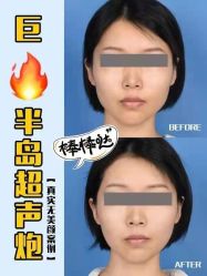 -联合丽格·张菡丽格医疗美容