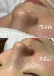 -LUNA皮相美·骨相美高级美感