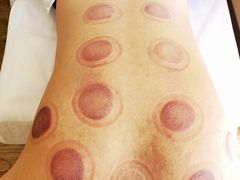 -筋骨堂热敷推拿按摩(枫林绿洲店)