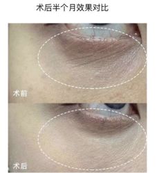 点击看大图 -AURAS璈然科技护肤中心